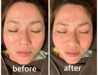 食べながら魅せボディ éclatJua川越のエステ・リラクイメージ