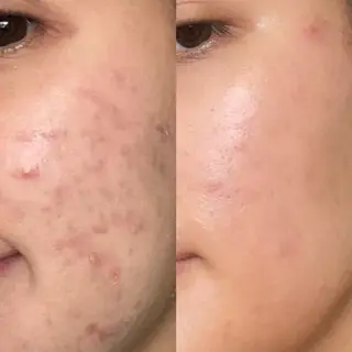 siro スタッフのエステ・リラクイメージ