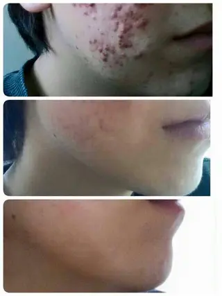 Sena Dewi Yukiの眉毛・アイブロウイメージ