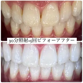 PLATINUM Beauty 横浜店所属・ホワイトニングルーム 横浜店のその他イメージ