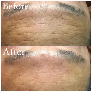 立体小顔×艶肌×美ボ ディ似合わせ施術 岡のエステ・リラクイメージ