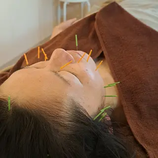 鍼灸サロンmiyabi所属・美容鍼×エステ　鍼灸 サロンmiyabiのエステ・リラクイメージ