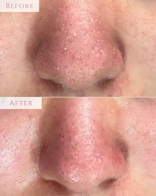 肌質改善専門サロン Bellmi/心斎橋のエステ・リラクイメージ