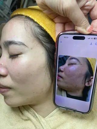 ニキビ、痩身、脱毛、 サクラチャンスパのエステ・リラクイメージ