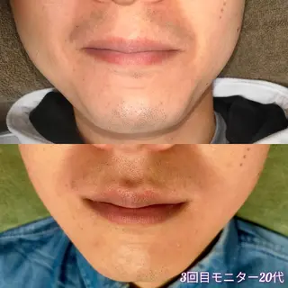 メンズ 武 藤のエステ・リラクイメージ