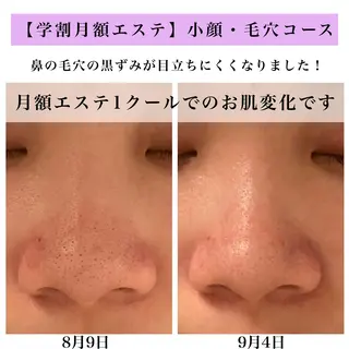 Bellesthe (ベルエステ)のエステ・リラクイメージ