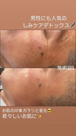 LiZA エステティックサロンのエステ・リラクイメージ