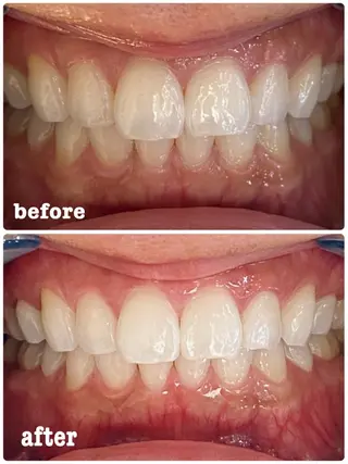 ホワイトニングサロン ラウレアのその他イメージ