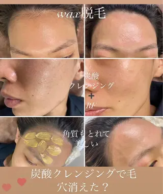 total beauty salon Raffoler所属・Raffoler りさのエステ・リラクイメージ
