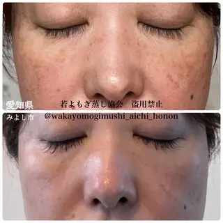 private salon Dea_maris シュガーリング&パーソナルボディケア所属・シミ改善・韓国肌管理 ボディメイク痩身のその他イメージ