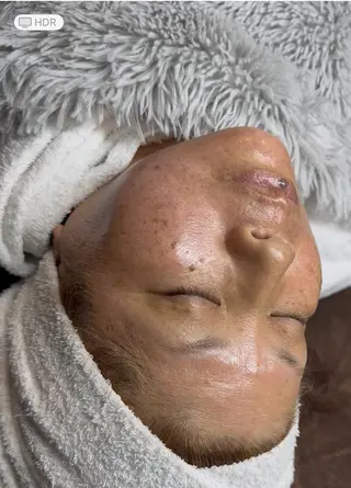 Honey Moom所属・Honey Moomのエステ・リラクイメージ