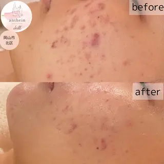 アンテインチル 山本のエステ・リラクイメージ