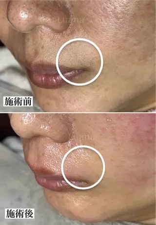 マツヤニWax専門/ 岸和田/Luanaのエステ・リラクイメージ