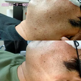 メンズ 武 藤のエステ・リラクイメージ