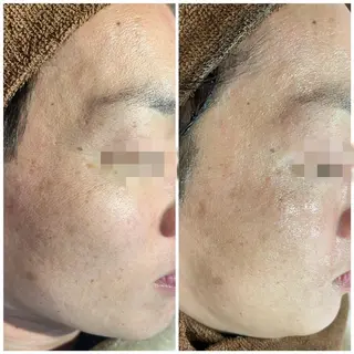 セミロング カラー パーマ ヘアアレンジ メンズ キッズ ネイル マツエク・マツパ アイブロウ Amaryllis 🌹松本のエステ・リラクイメージ