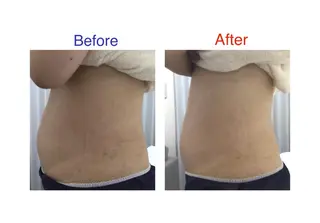 子宮矯正/腸揉み/ シュガーリング脱毛のエステ・リラクイメージ