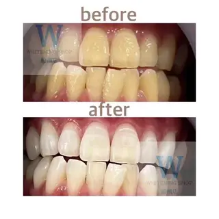 ホワイトニング ショップ船橋店のエステ・リラクイメージ