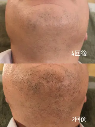 プライベートサロン宿り木所属・江坂@宿り木　脱毛＆ 耳ツボジュエリーのその他イメージ