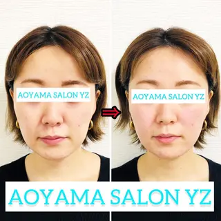 小顔美容鍼専門サロン 渋谷YZのエステ・リラクイメージ