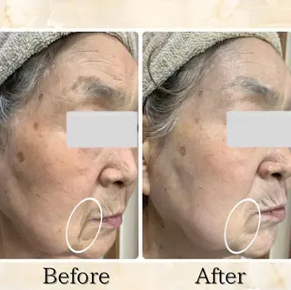 Lumiere despoir所属・Lumiere despoirのエステ・リラクイメージ