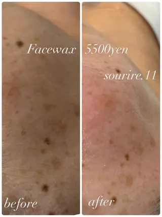 sourire.11 ‪☺︎‬‪emiのエステ・リラクイメージ