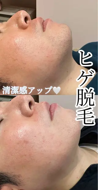 メンズ キッズ Amaryllis 🌹松本のエステ・リラクイメージ