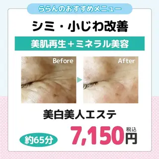 若返り 美肌   エステサロンららんのエステ・リラクイメージ