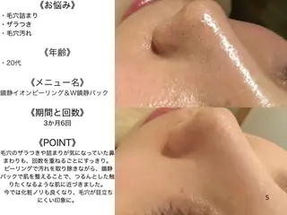 憧れ韓流素肌に🪽 毛穴肌管理のエステ・リラクイメージ