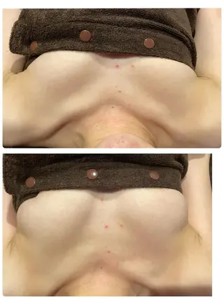 Monreve所属・美人スイッチdiet スーパージェクションのその他イメージ