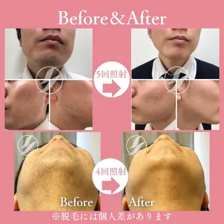 メンズ 有人型セルフサロン 脱毛/痩身/美顔のその他イメージ