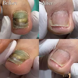 東京巻き爪アカデミー所属・東京巻き爪 アカデミーのエステ・リラクイメージ