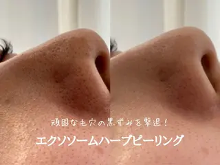 最速小顔・肌質管理 ❣️エスポワールのエステ・リラクイメージ