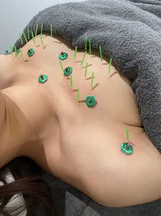 メディカルサロンドオフ所属・ハリサロンドオフ 美容鍼灸×小顔整体のエステ・リラクイメージ