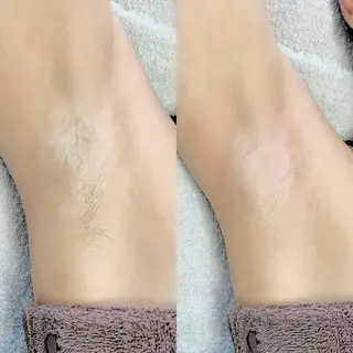 メンズ salonLADYSTYLE所属・稲嶺 美華のエステ・リラクイメージ