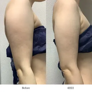 冷却専門店 SLARIのエステ・リラクイメージ