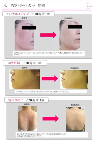 FLEUR大阪・美容 整体・痩身・小顔のエステ・リラクイメージ