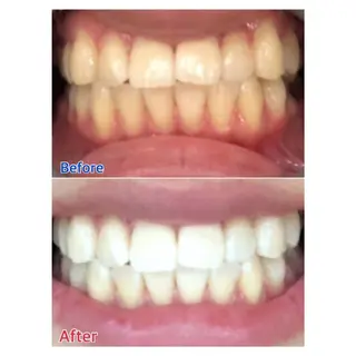 MBEAUTYSALON 千葉店・京成大久保所属・Melty 輝のその他イメージ