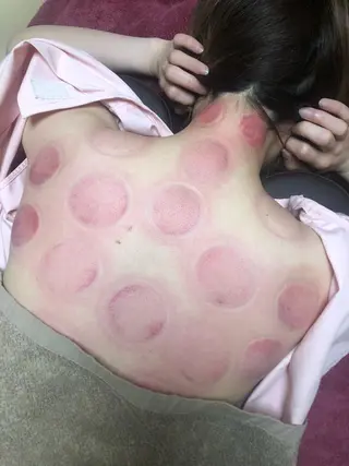 美容鍼灸女性専用 りんご鍼灸治療院のその他イメージ