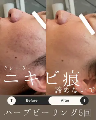 Anpawman所属・Anpawman アンパウマンのエステ・リラクイメージ