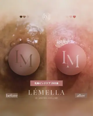NAIL＆EYELASH SALON Lovers MOMO ～ラヴァーズ モモ～所属・Lovers MOMOのエステ・リラクイメージ