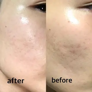 未病ケアサロン EMINY所属・未病ケアサロン EMINY☺︎勝俣のエステ・リラクイメージ