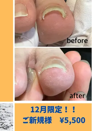 ネイル 巻き爪補正店 堺東店のネイルデザイン