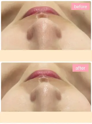 Monart -deux-のエステ・リラクイメージ