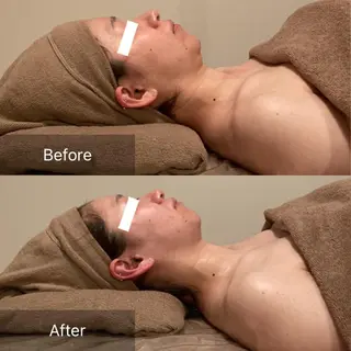 B&H所属・頭痛•肩こり専門/ 眉サロンB&H心斎橋のエステ・リラクイメージ