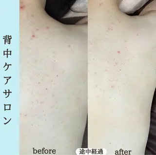 ベラージュ【美背中・ 美尻・フェイシャル】のエステ・リラクイメージ