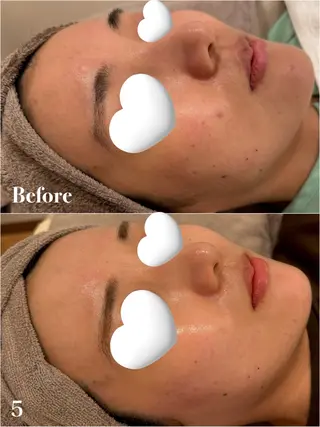 Ayaka🤍 恵比寿/美容鍼/整体のエステ・リラクイメージ