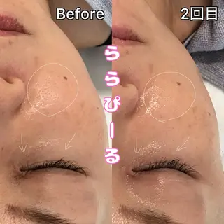 天神 MeMeのエステ・リラクイメージ