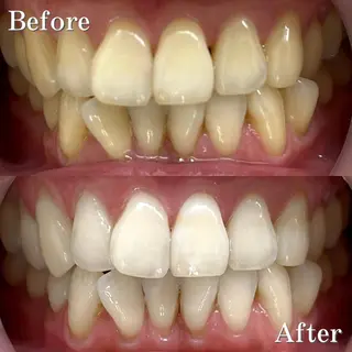 LBSホワイトニング 銀座店💎店長浦和のその他イメージ