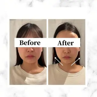 12Dハイフ💗 最強小顔のエステ・リラクイメージ