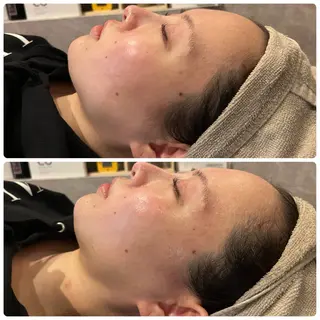 yellow.所属・yellow💛【 脱毛&フェイシャル】のエステ・リラクイメージ